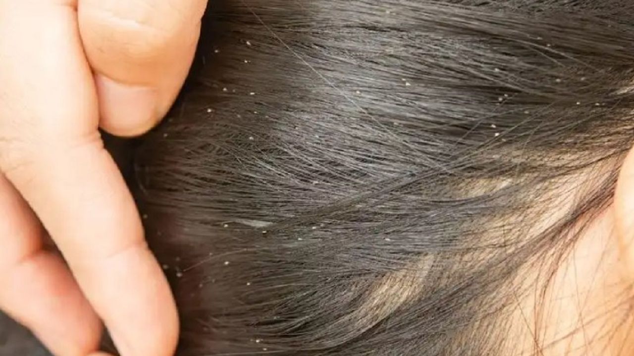 Saç sirkesi nedir, ne işe yarar, nasıl kullanılır?