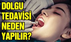 Diş Dolgusu Nasıl Yapılır? Dolgu Tedavisi Neden Yapılır? Çeşitleri Nelerdir?