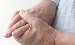 Romatoid Artrit nedir? Tedavi yolları nelerdir?
