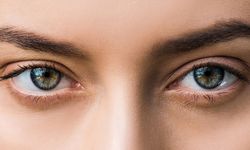 Göz altı morlukları neden olur? Çocuklarda & Yetişkinlerde
