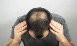 Hemen uygulayın! Saç dökülmesini yüzde 40 azaltıyor