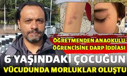 Öğretmenin şiddetine uğrayan 6 yaşındaki çocuk psikolojik destek alıyor