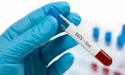 Gençlerde HIV Enfeksiyonu Artıyor