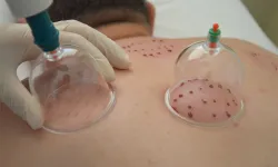 Hacamat hangi sıklıkla yapılmalı? İki hacamat arası ne kadar süre olmalı?