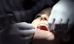 Uzmanı Uyardı! Diş Eksikliği Bağırsakları Çökertiyor!