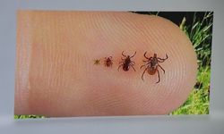 Yaz Sıcağı Kene Riskini Artırdı! 1 Kene, 10 Bine Yakın Yumurta Bırakıyor
