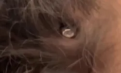 Kafasına mermi saplanan kız çocuğu hayata tutundu!