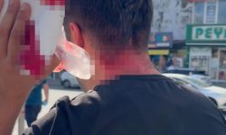 Vekilin cenazesinde darbedilip hastanelik oldu