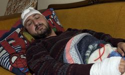 Vicdanları yaralayan olay! Otizmli şahıs odunla darbedildi