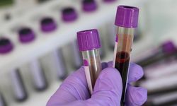 Kan kanserinde "immünoterapilerle" tedavide yeni dönem