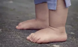 Çocuklarda düztabanlığın 4 önemli sinyaline dikkat! Uzman isim düztabanlıkla ilgili bilgi verdi…