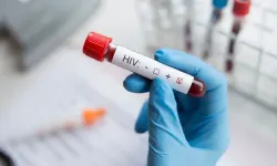 HIV'de kırmızı alarm! 7,7 milyon kişi HIV'den ölebilir! Uzmanından önemli uyarı…