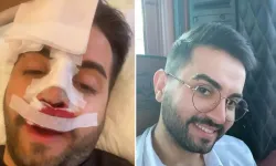 Kaza Mı, Estetik Mi? Kadir Ezildi'nin burnuna ne oldu? Fotoğrafı Sosyal Medyayı Ayağa Kaldırdı