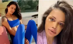 Kore estetiği nedir ve Didem Ceran’ın estetik sürecinde nasıl uygulandı?