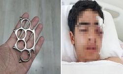 Akran zorbalığına bir yenisi eklendi! 15 yaşındaki çocuk muştayla öldüresiye dövüldü