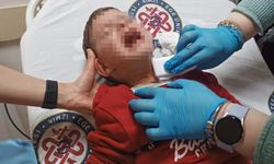 Parkta bıçaklı dehşet! 2 yaşındaki çocuk boğazından yaralandı…