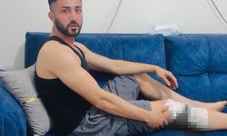 Gaziantep’te sokak köpeği dehşeti! 2 kişi yaralandı…