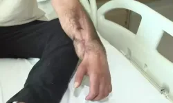 Elektrik akımına kapılan işçi, doku nakliyle Gaziantep'te yaşama tutundu!