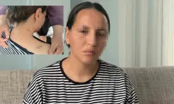 Vahşetten “ölü numarası” yaparak kurtuldu! 17 bıçak darbesi alan kadın adalet istiyor!