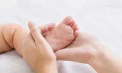 El ayak ağız hastalığında çocuklarda bu belirtilere dikkat! Uzman isim uyardı…