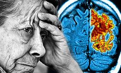 Kişilik ve davranış değişikliği Alzheimer belirtisi olabiliyor