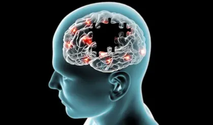Gaziantepliler dikkat! Alzheimer'ın izleri unutkanlıktan yıllar önce başlayabiliyor