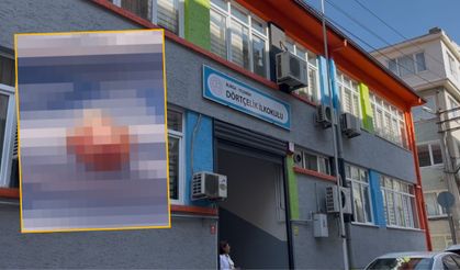 İlkokulda korkunç olay! Çocuğun parmağı koptu, ders devam etti: Video haber…