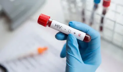 HIV'de kırmızı alarm! 7,7 milyon kişi HIV'den ölebilir! Uzmanından önemli uyarı…
