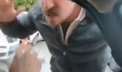 Ailesinin yanında saldırıya uğradı: Olayın faturası 430 bin lira oldu