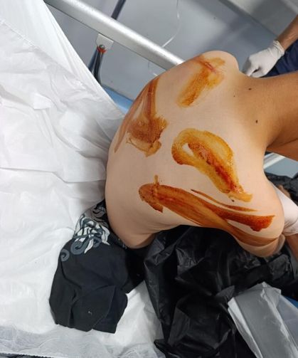 11 Yaşındaki Çocuğa Sopalı Dehşet! Hastanelik Oldu