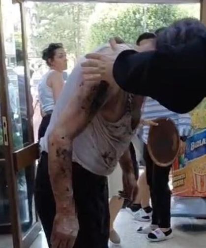 Lavabo açıcı bomba gibi patladı: 2 Yaralı