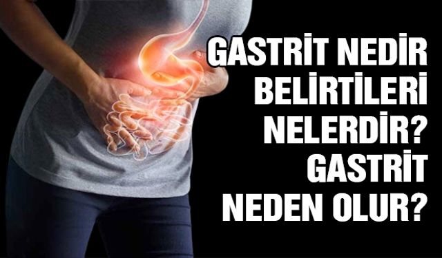 Gastrit nedir, belirtileri nelerdir? Gastrit neden olur?