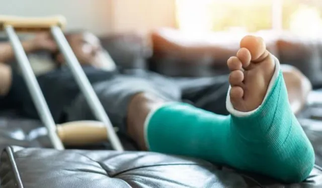 Kırık Kemiklerin Hızlıca İyileşmesi İçin Yapılması Gerekenler: Beslenmeden Fizik Tedaviye