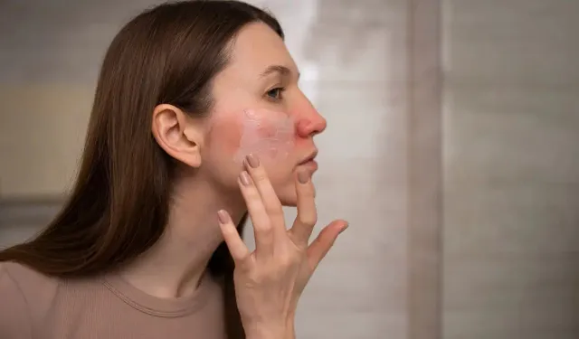 Kış aylarında görülen deri hastalıklarına dikkat! Uzmanından kritik uyarı…