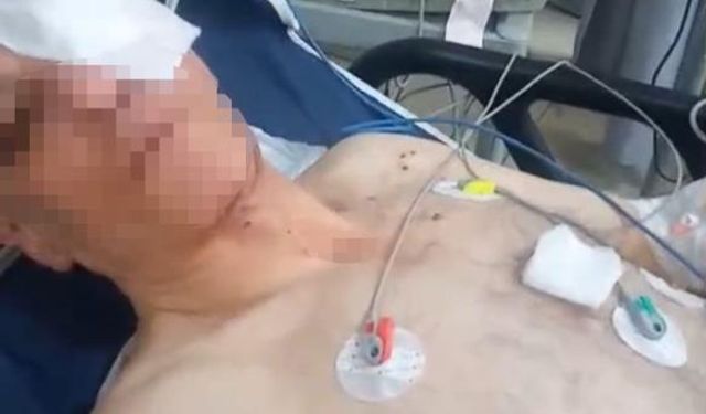 Pompalı tüfekle çevreye ateş eden şahıs, 1'i polis 4 kişiyi yaraladı