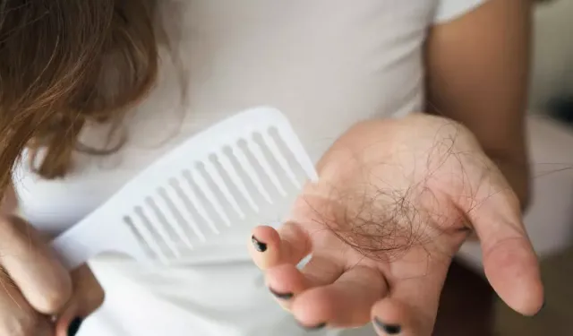 Kadınlarda saç dökülmesinin gizli nedenleri! Uzman isim açıkladı!