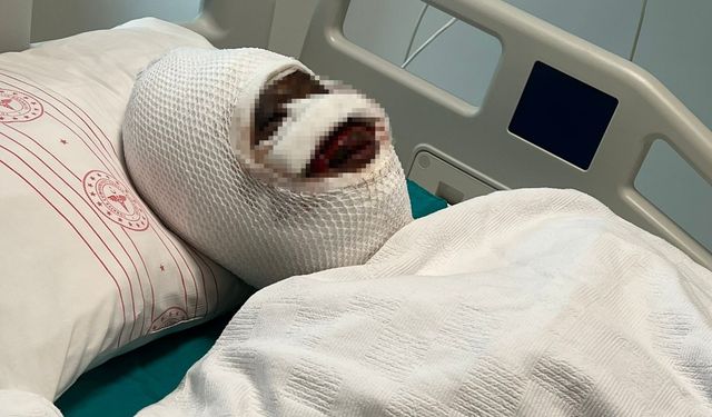 Gaziantep’te eski eş dehşeti! Talihsiz kadın korkunç anları anlattı!