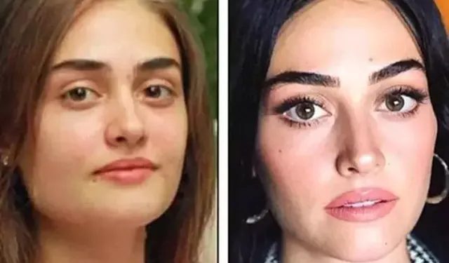 Estetik Yaptırdı Mı? Esra Bilgiç Kimdir, Kaç Yaşında, Nereli?