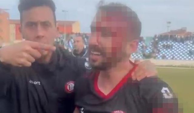 Amatör ligde saha karıştı: 3 futbolcu yaralandı