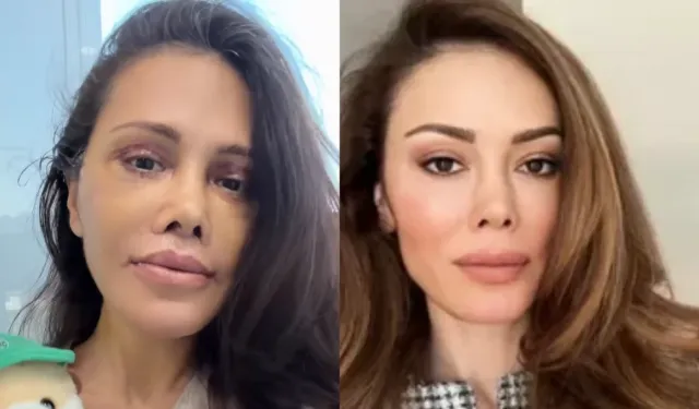 Didem Ceran kimdir, kaç yaşında? Yüz nakli mi oldu, aslen nereli, ne iş yapıyor?