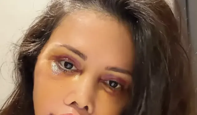 Didem Ceran kimdir, kaç yaşında, nereli? Survivor Didem Ceran neden ameliyat oldu?