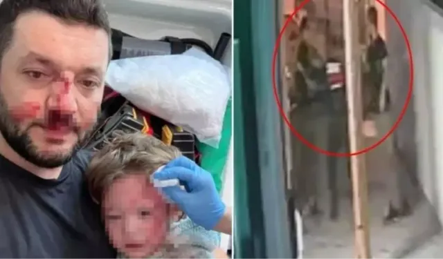 Yalova Çınarcık Esenköy saldırı olayı nedir, ne oldu? Baba ile 14 aylık bebeğinin darbedildiği görüntüler yayınlandı mı?