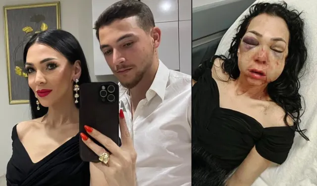 Meryem Yıldırım kimdir, İzmit’te neden darp edildi, saldırganlar tutuklandı mı?