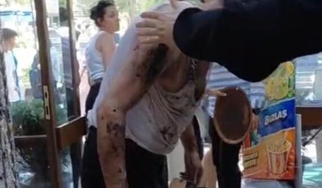 Lavabo açıcı bomba gibi patladı: 2 Yaralı