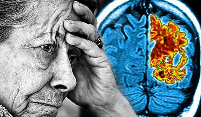 Kişilik ve davranış değişikliği Alzheimer belirtisi olabiliyor