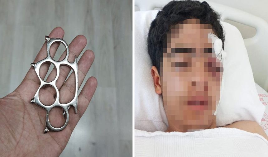 Akran zorbalığına bir yenisi eklendi! 15 yaşındaki çocuk muştayla öldüresiye dövüldü