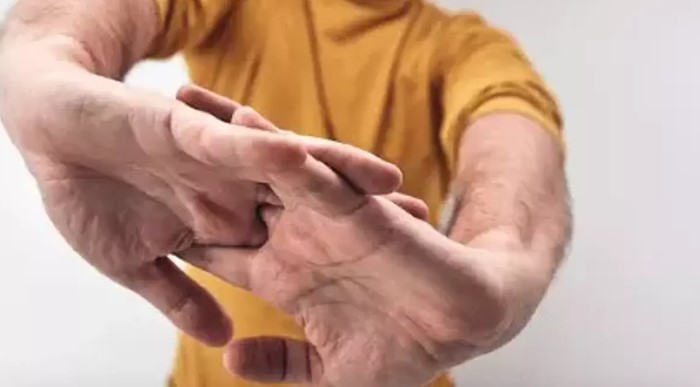 STRES
Stres altındaki kişiler, parmaklarını çıtlatmak suretiyle rahatlama sağlar. Bu eylem, kısa süreliğine de olsa stresin azalmasına yardımcı olabilir.
