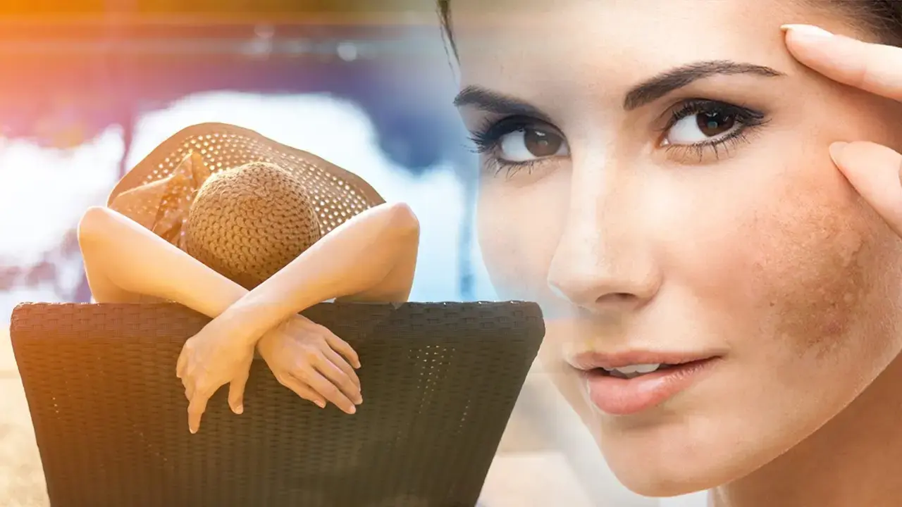 Güneş lekesi sandığınız o iz, ölümcül bir tehlike olabilir! Uzman isim uyardı…
